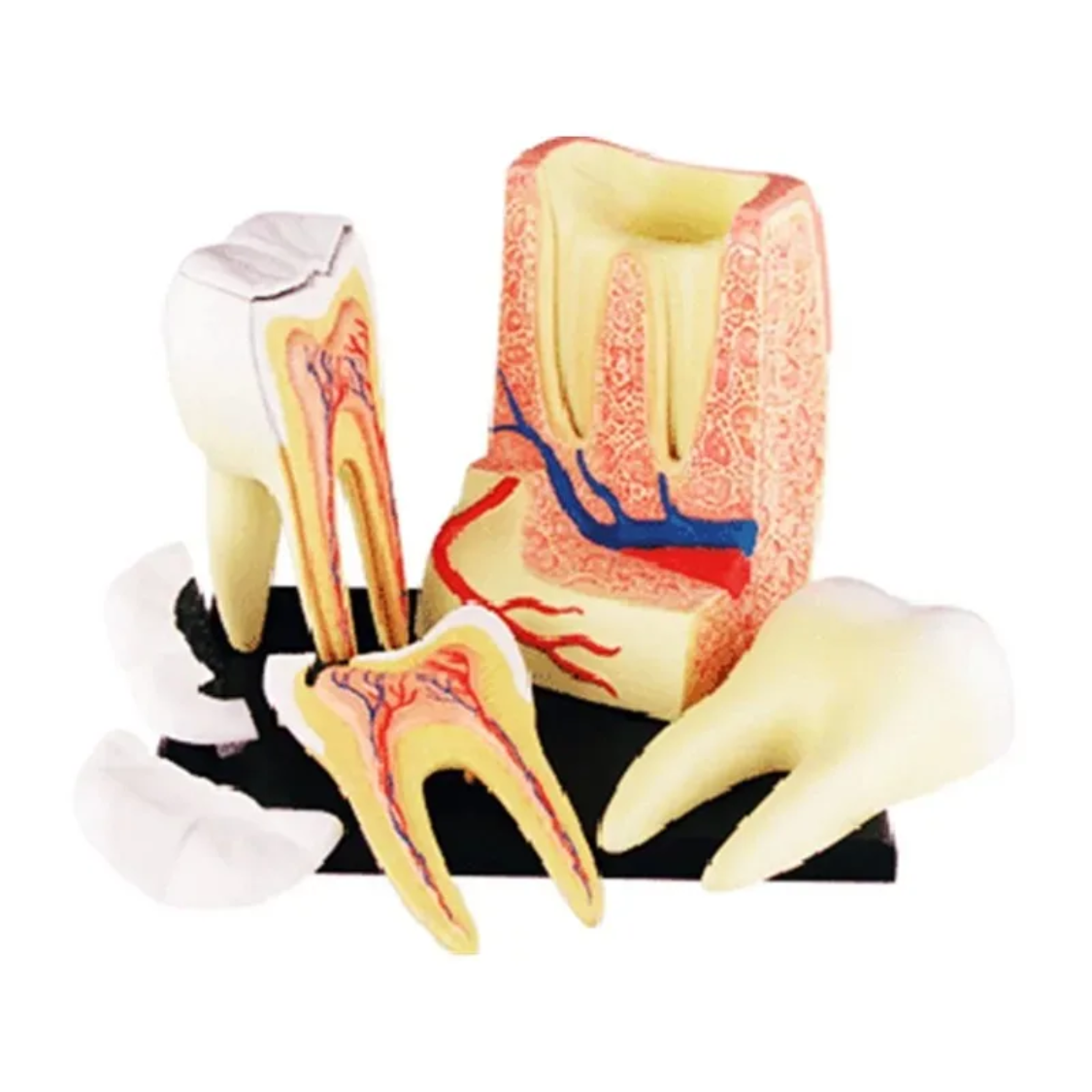 Zahn-Modell Molaris mit 23 Teilen zum Zusammenbauen (2) 3-Wurzeliges Backenzahn-Modell "Molaris" 23-Teilig – Bild 1